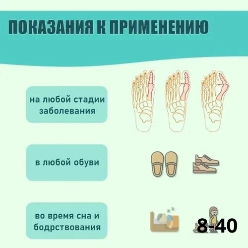 Корректор большого пальца стопы, силиконовая накладка с разделителем и доп. кольцом