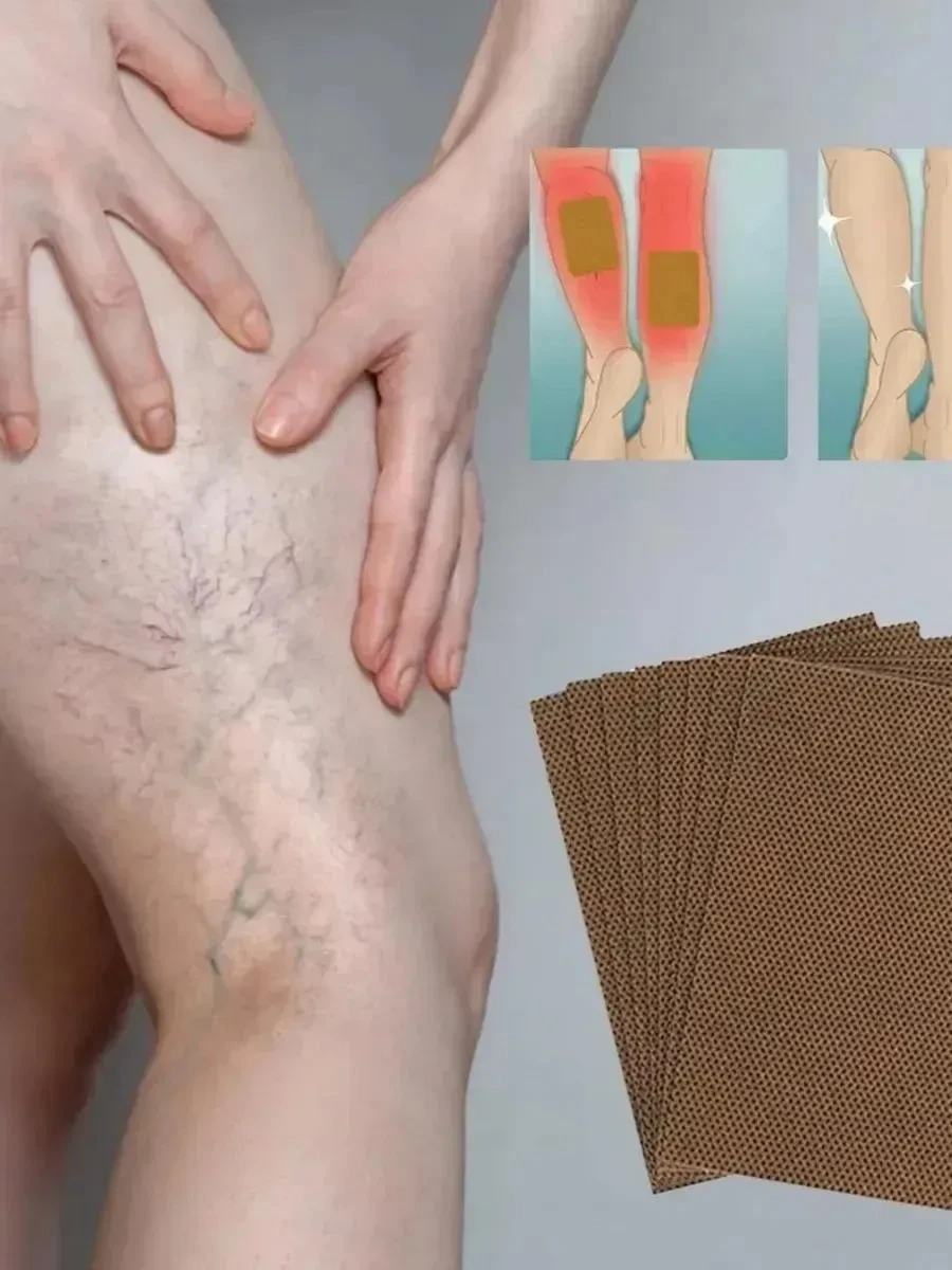 ПЛАСТЫРЬ ПРОТИВ ВАРИКОЗА