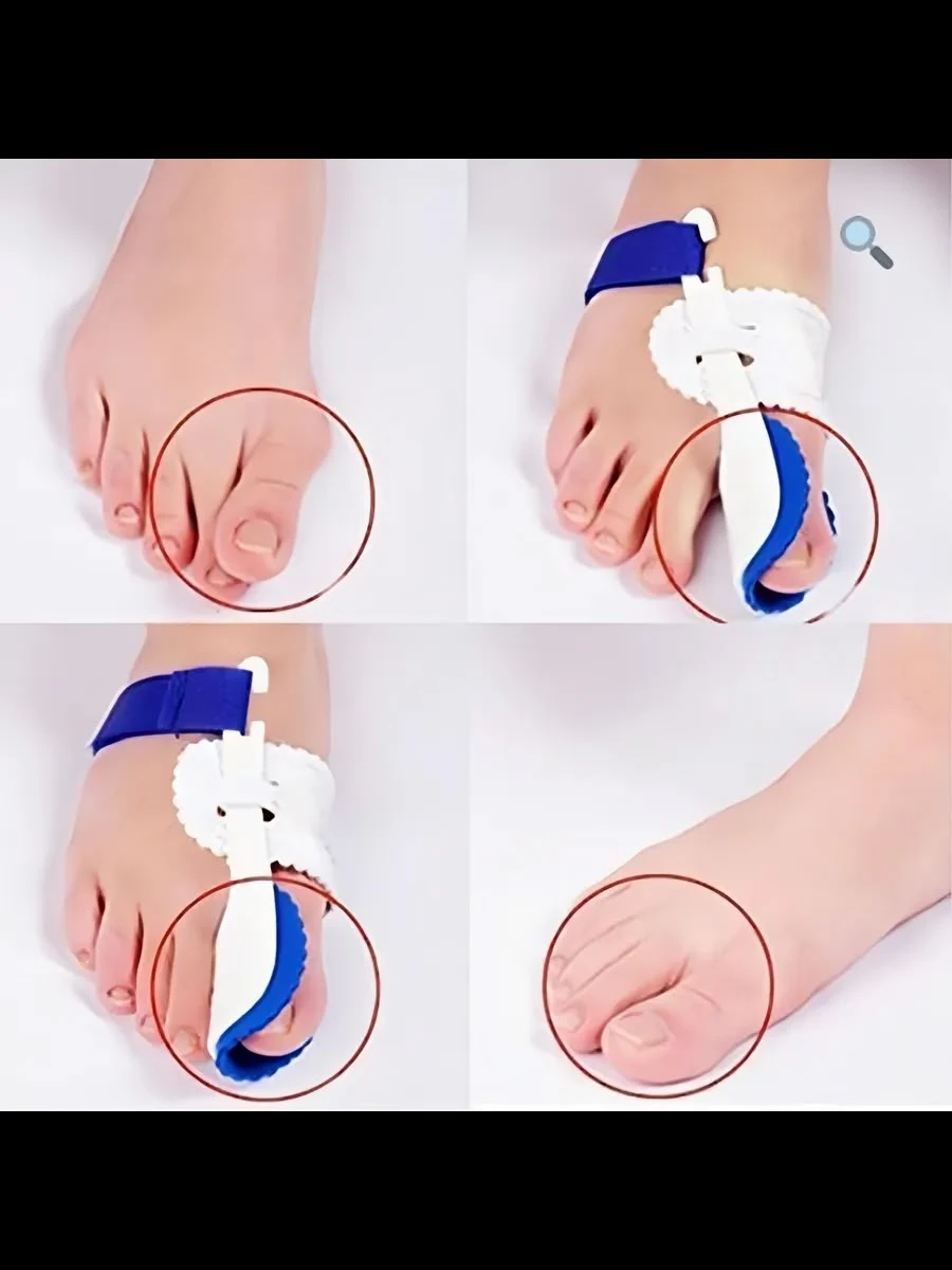 корректор вальгусной деформации большого пальца ноги